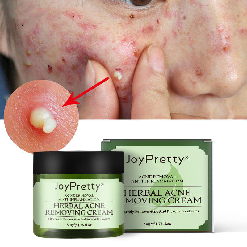 Herbal Acne Cream For Reducing Acne Marks Herbal Acne Cream For Reducing Acne Marks